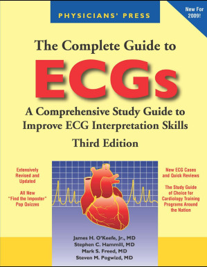 The Complete Guide to EKGs